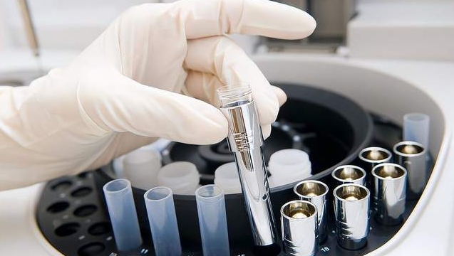 液氮存儲(chǔ) 液氮存儲(chǔ)